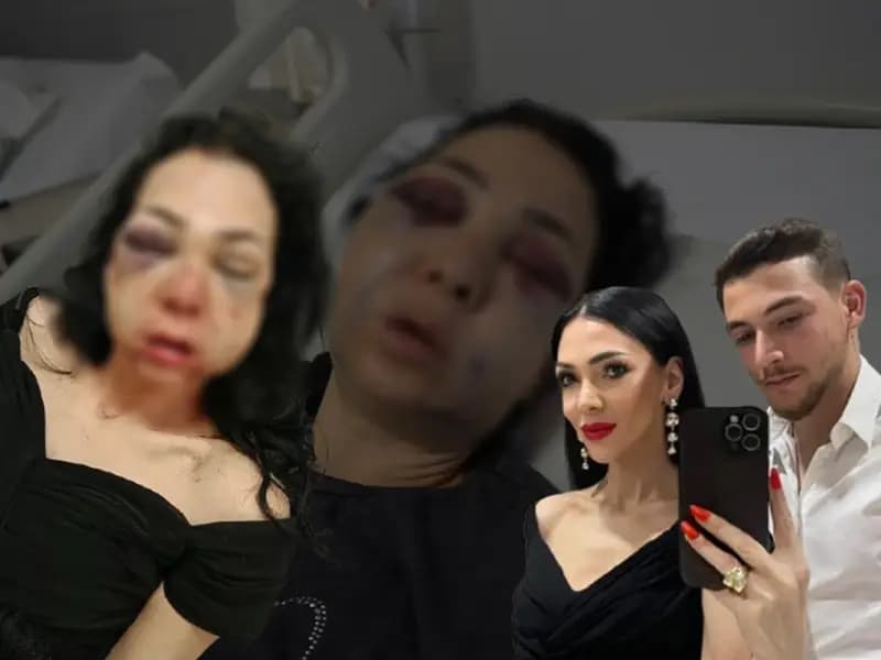 Kocaeli'de Kafede Çıkan Arbede: Anne ve Oğlu Saldırıya Uğradı