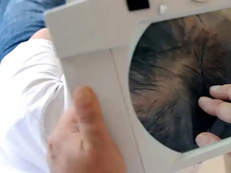 İstanbul'da Saç Ekimi Sonrası Yaşanan Trajedi: Genç Adam Hayatını Kaybetti