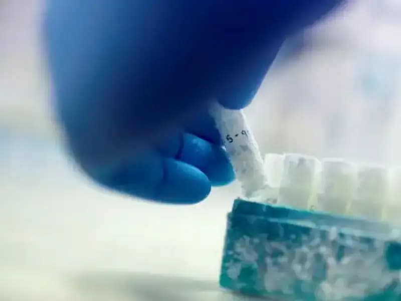 85 Sperm Donörü: Tıbbi Felaket ile Binlerce Çocuğun Baba Olma Hikayesi