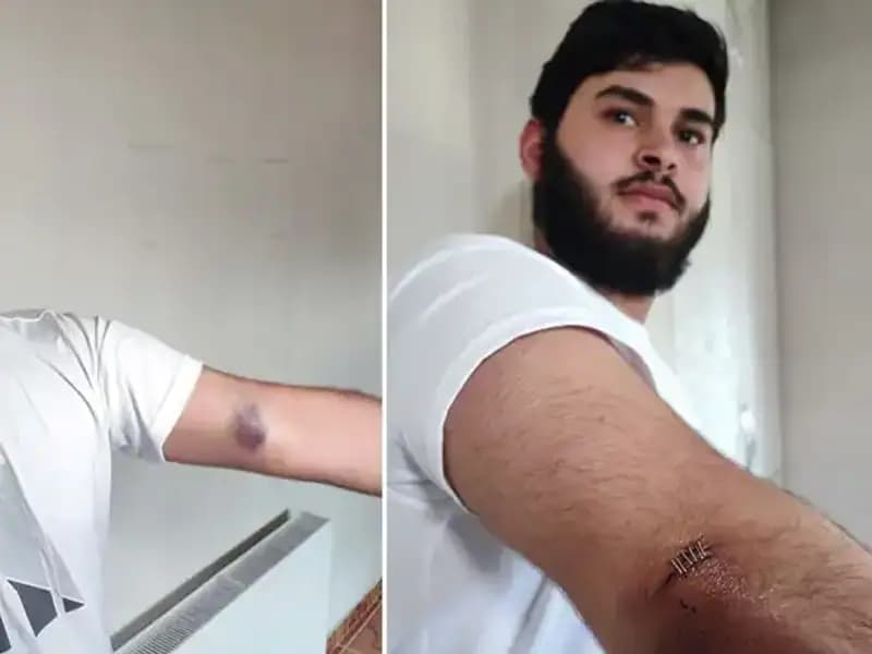 Bahçeye Kaçan Top, Mahallede Hızla Yayılacak Olaylar Serisi Başlattı!