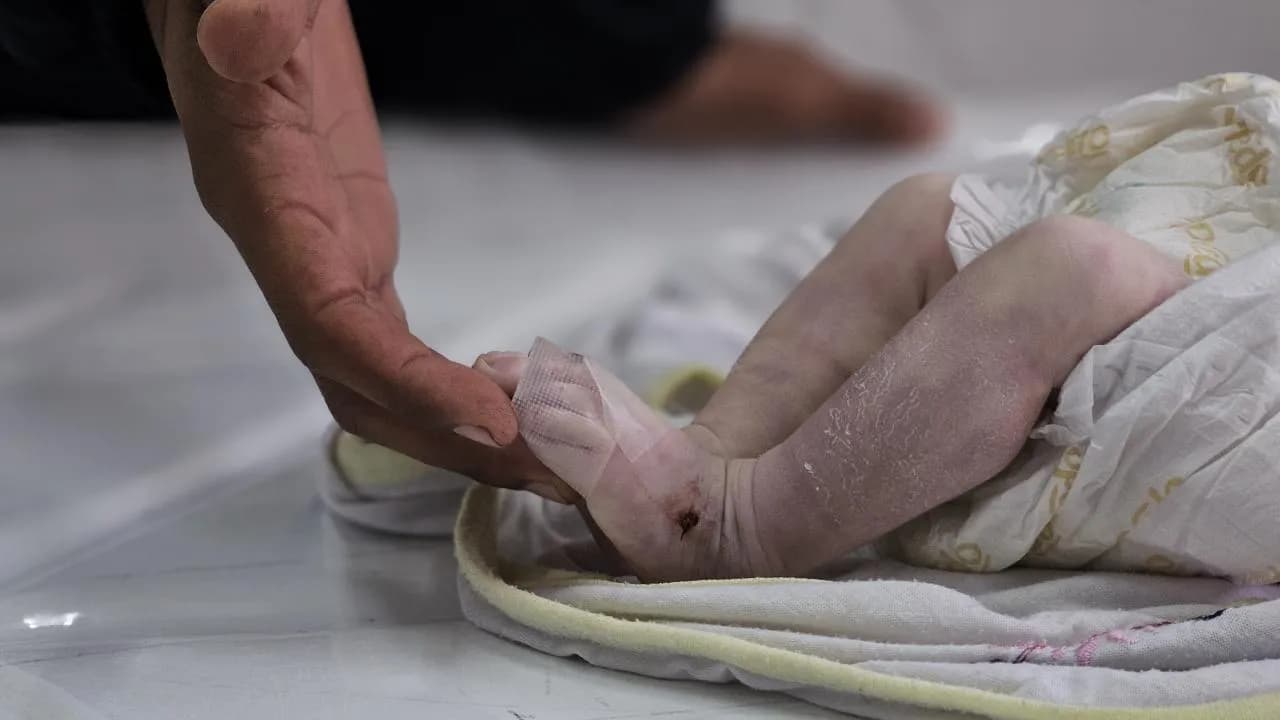 Gazze'de Soğuktan Ölmelerine Engel Olmak için Aileler Nöbette